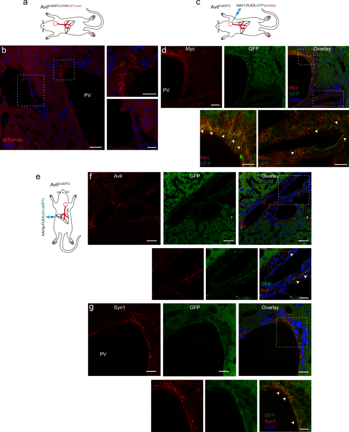 Fig. 3: Avil-positive vagal sensory neurons send axonal projections to the periportal area.