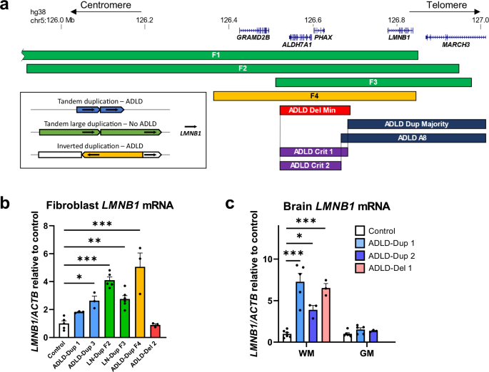 Fig. 2: LMNB1 structural variants and expression analysis.