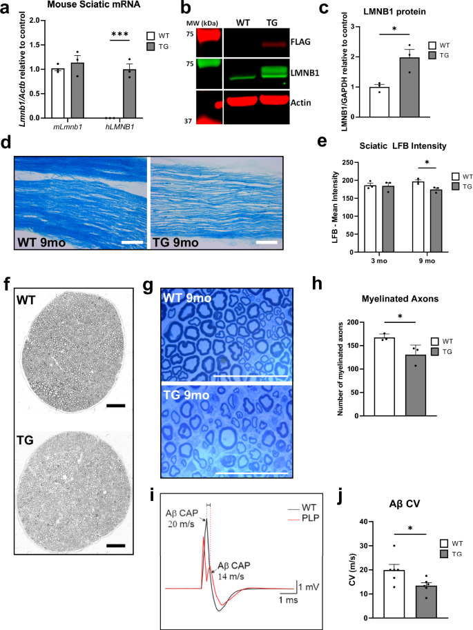 Fig. 3: Peripheral nerve degeneration in LMNB1 overexpressing TG mice.