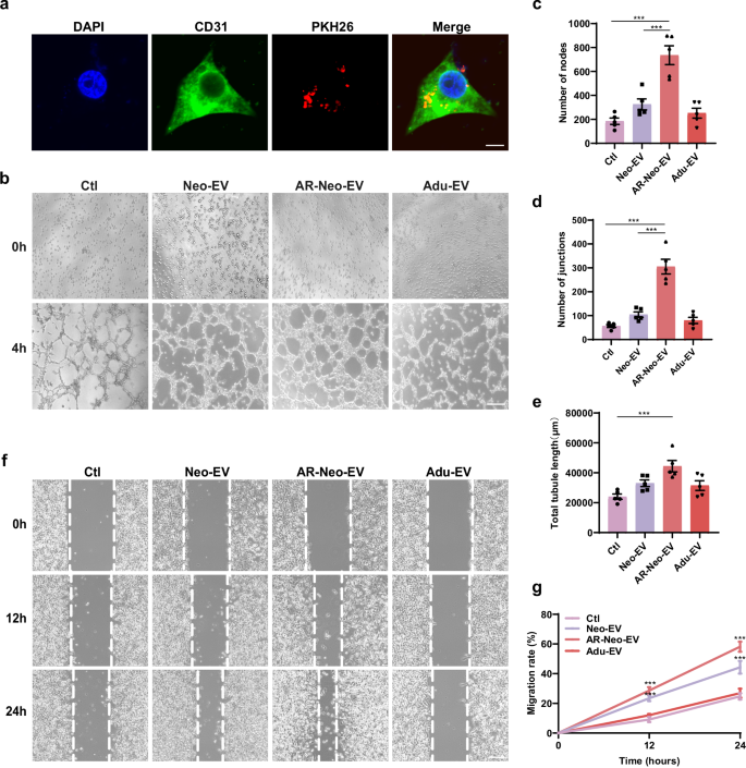 Fig. 2: Effects of Neo-EVs, AR-Neo-EVs, and Adu-EVs on angiogenesis of Human umbilical vein endothelial cells (HUVECs) in vitro.