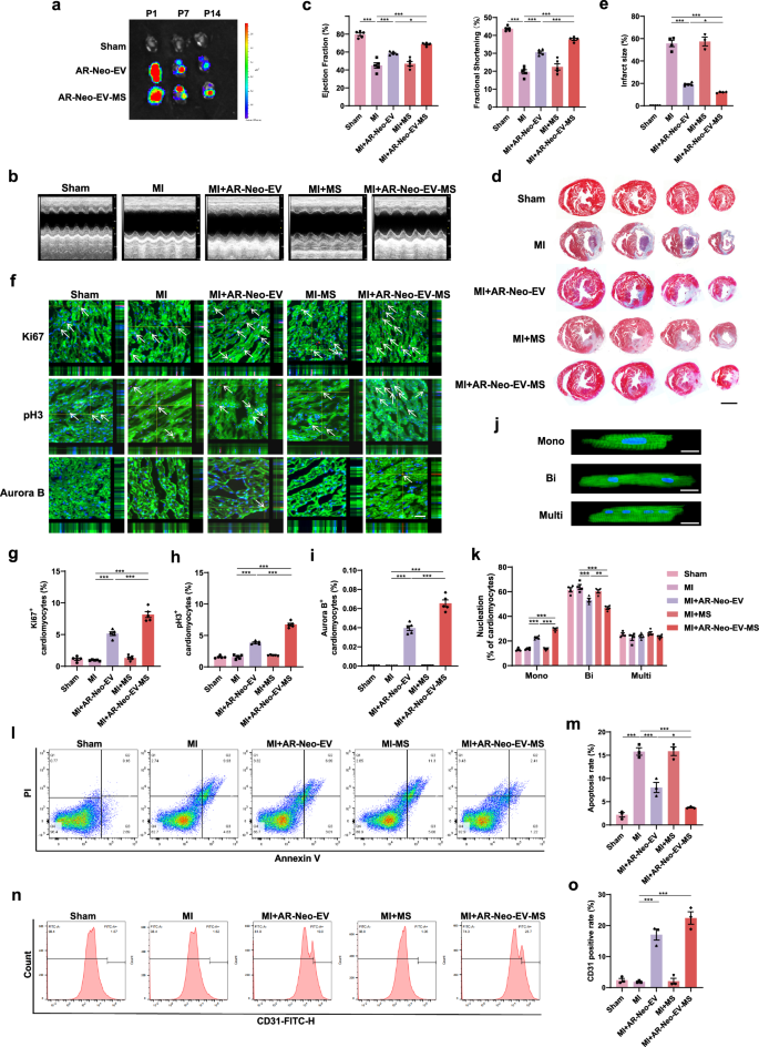 Fig. 5: Delivery of AR-Neo-EVs via MS can futher promote post-MI cardiac function recovery.