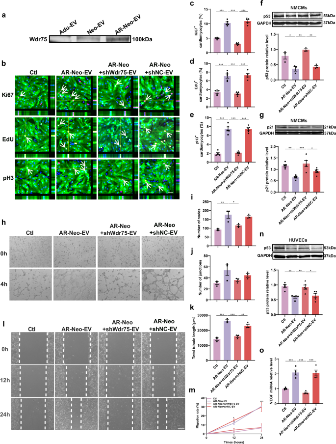 Fig. 7: WD repeat domain 75 (Wdr75) protein plays a critical role in AR-Neo-EVs mediated cardiomyocyte proliferation and angiogenesis in vitro.