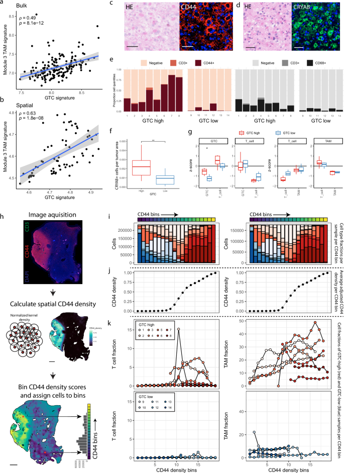 Fig. 5: CD44-positive gemistocytic tumor cells form a network with immune-reactive TAMs that phenotypically characterizes the stroma surrounding T cell cuffs in IDHmt astrocytoma.