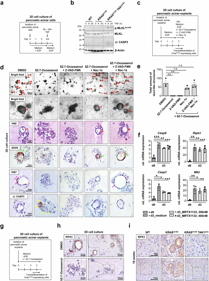 Fig. 2: Transdifferentiation sensitizes acinar cells to apoptotic and necroptotic PCD.