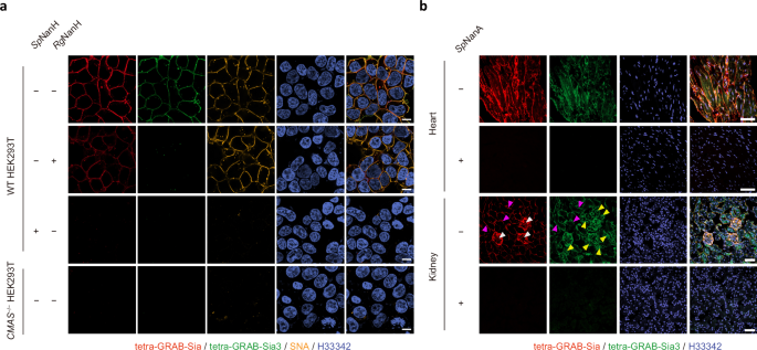 Fig. 5: Fluorescence imaging of sialoglycans with tetra-GRABs.
