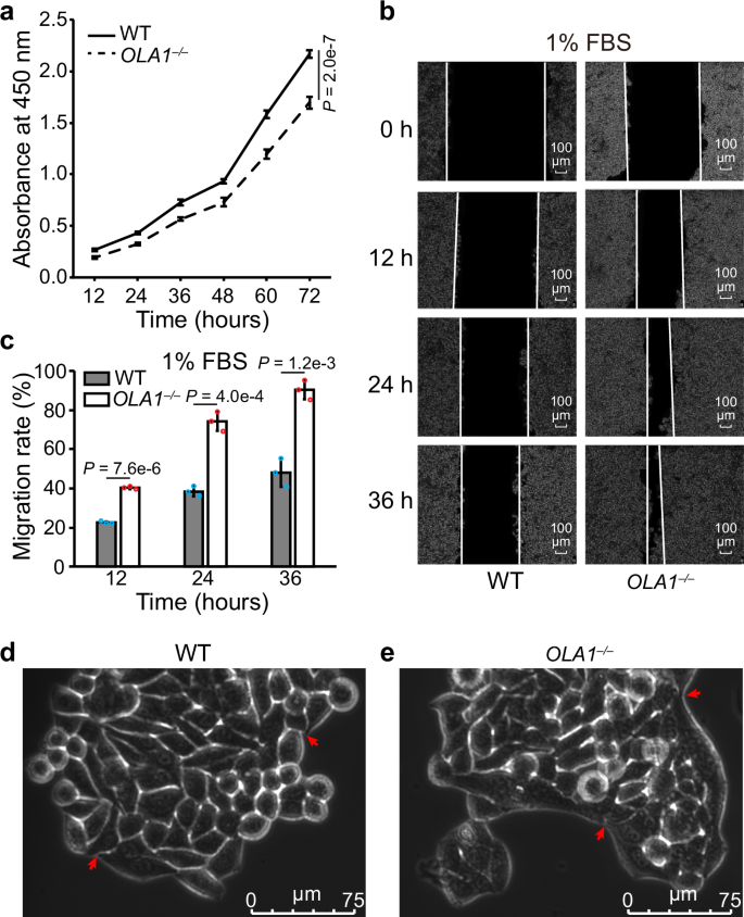Fig. 4: OLA1 plays critical cellular functions in Hela cells.