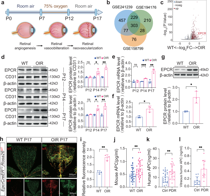 Fig. 1: EPCR is specifically highly expressed in retinal neovascularization.