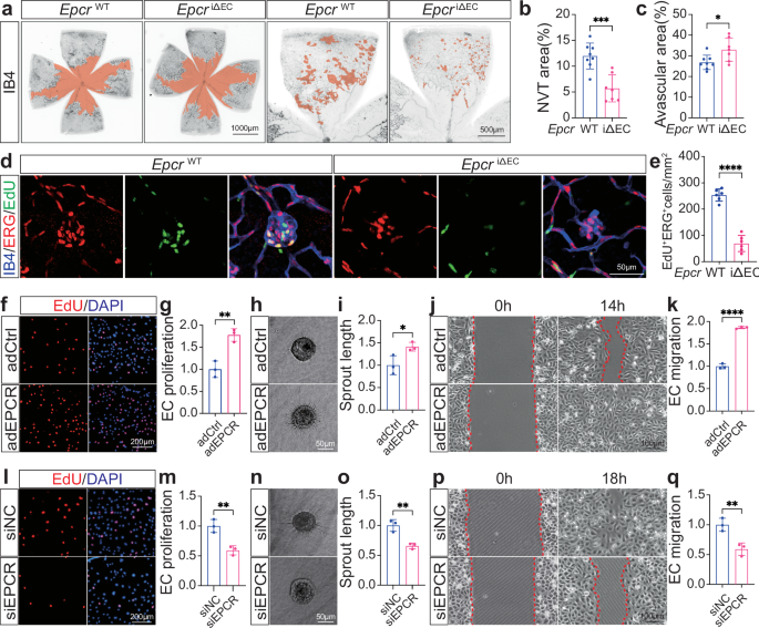 Fig. 2: Loss of endothelial Epcr suppresses pathological RNV.