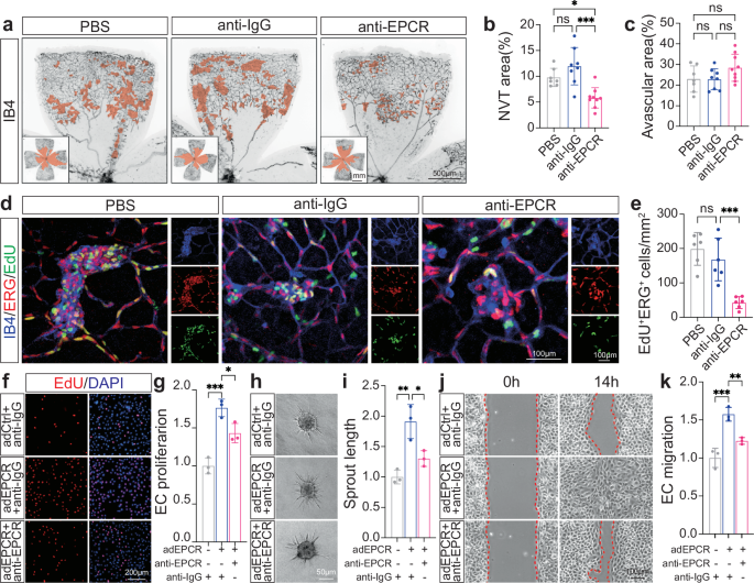 Fig. 3: Pharmacological inhibition of EPCR attenuates pathological RNV.
