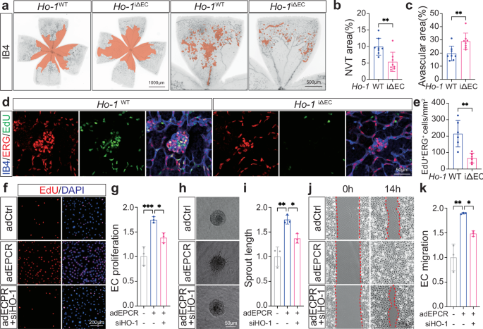 Fig. 5: Endothelial deletion of Ho-1 inhibits pathological RNV.