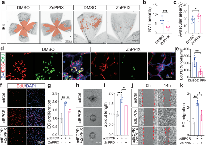 Fig. 6: Endothelial heme catabolism inhibition ameliorates RNV.