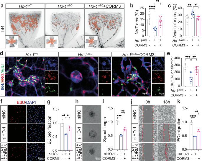Fig. 7: CO rescued the phenotype of Ho-1 deletion in vitro and in vivo.