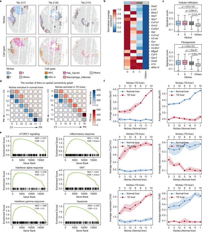 Fig. 8: scNiche uncovers disease-specific liver injury niches and delineates the niche remodeling from normal liver to liver failure.