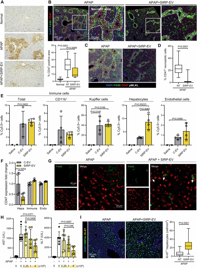 Fig. 5: SIRP-EV targets CD47-expressing necroptotic hepatocytes to promote therapeutic efficacy via enhanced efferocytosis and liver regeneration in ALF.