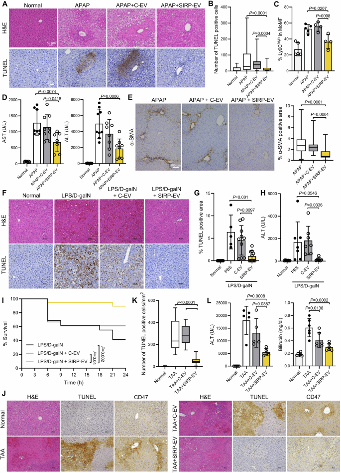 Fig. 6: SIRP-EV outperforms C-EV in ALF models, attributed to SIRPα expression.