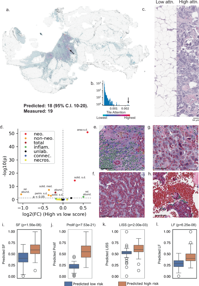 Fig. 4: Cellular and transcriptomic correlates of risk.