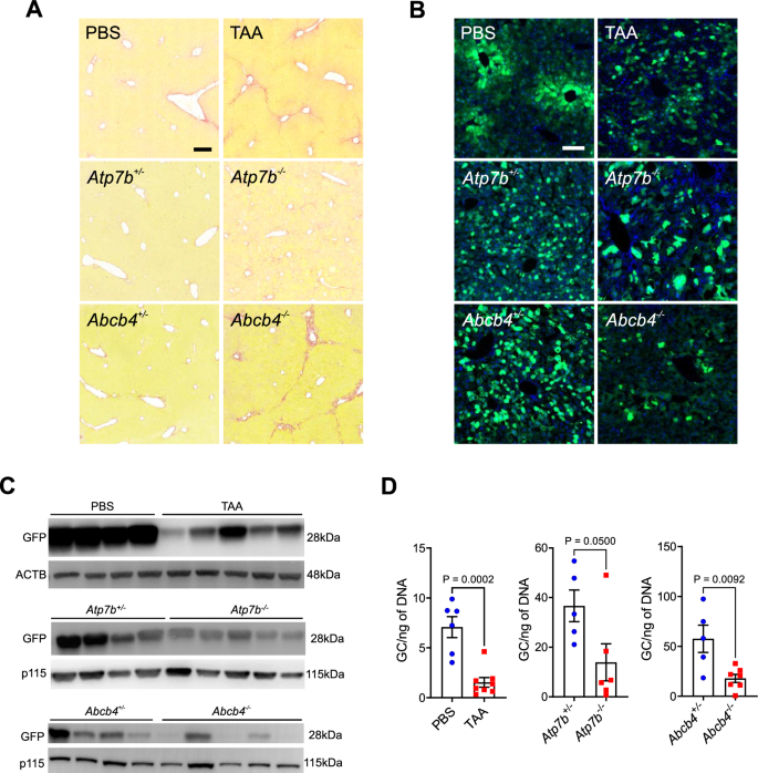 Fig. 1: Reduced AAV8 transduction in liver fibrosis mouse models.