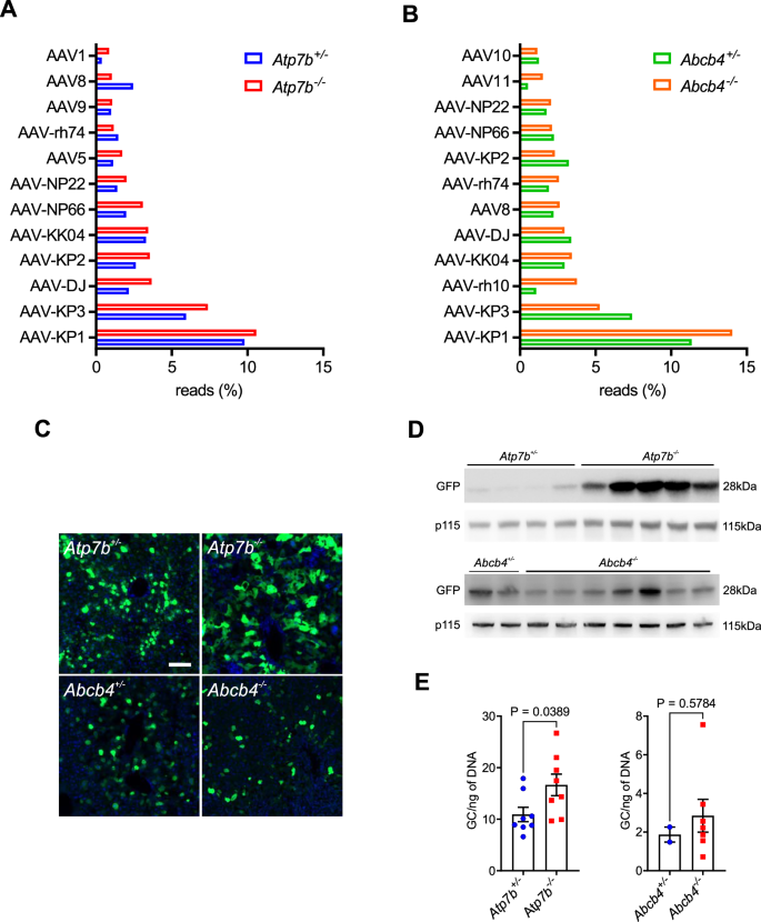 Fig. 5: Liver fibrosis impacts gene transfer in a capsid-dependent fashion and does not affect AAV-KP1.