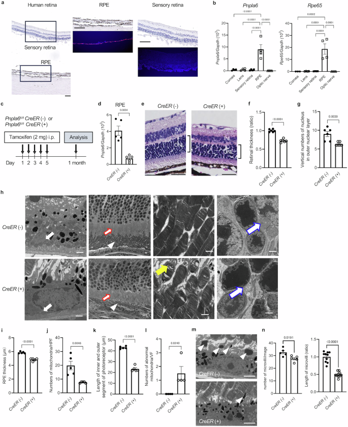 Fig. 1: Histological features of the retina in tamoxifen-inducible systemic Pnpla6-deficient mice.