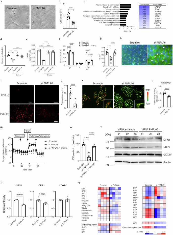 Fig. 4: PNPLA6 knockdown alters cellular function and metabolism in ARPE-19 cells.