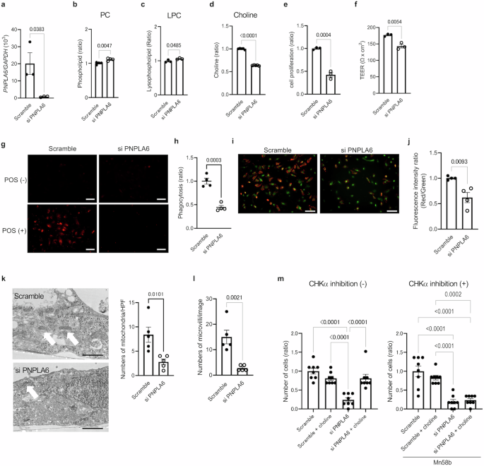 Fig. 5: PNPLA6 knockdown in primary human RPE cells disturbs choline turnover.