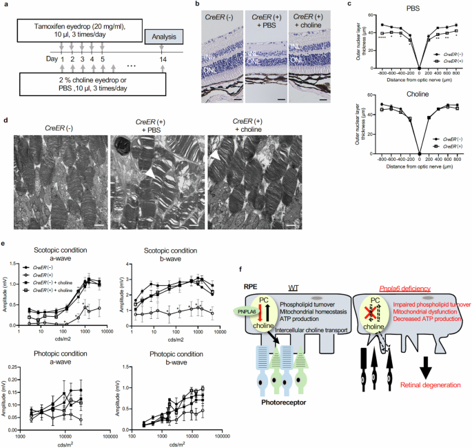 Fig. 7: Topical application of choline prevents retinal degeneration in Pnpla6-deficient mice.