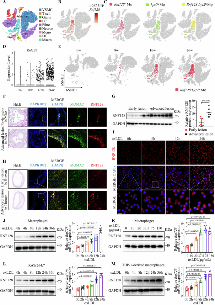 Fig. 1: The expression of RNF128 in macrophages is augmented during atherogenesis.