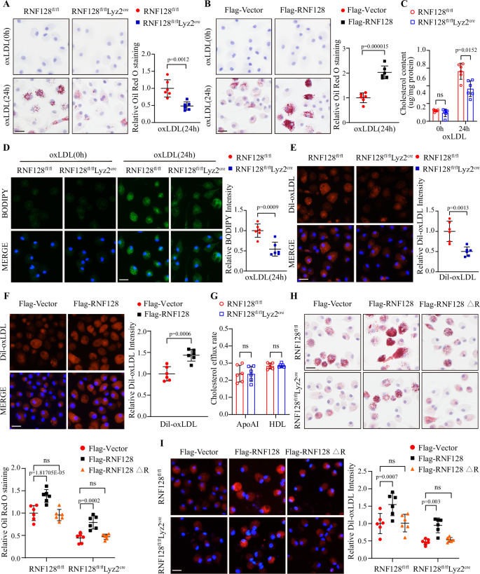 Fig. 2: Macrophage-specific deletion of RNF128 attenuates foam cell formation via reducing lipid uptake.