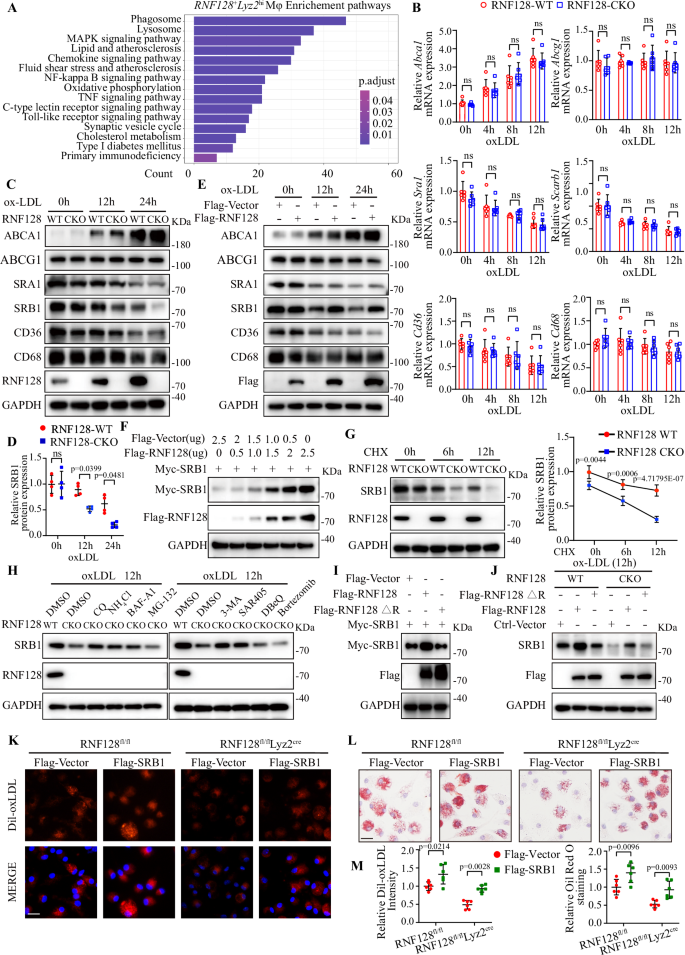 Fig. 3: RNF128 deficiency downregulates SRB1 protein level and inhibits foam cell formation.