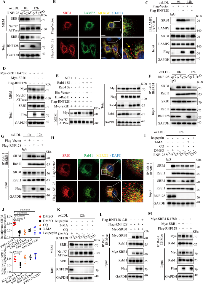 Fig. 6: RNF128-mediated ubiquitination of SRB1 promotes its recycling to the membrane via Rab11.