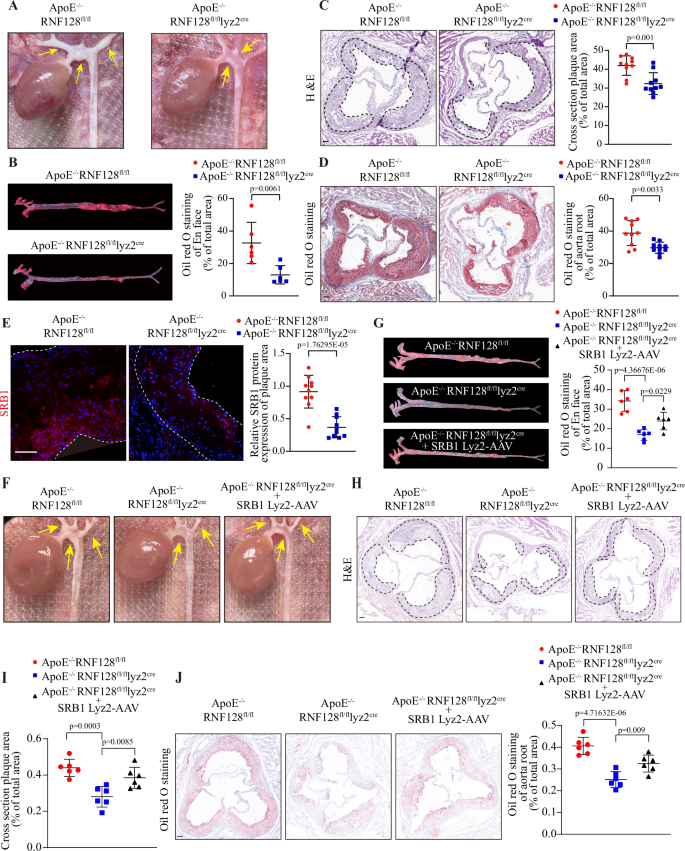Fig. 7: Macrophage-specific deletion of RNF128 ameliorates atherosclerosis (males).