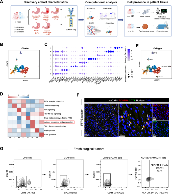 Fig. 1: Identification of antigen-presenting CAFs in patients with GC.