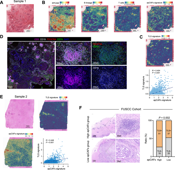Fig. 3: apCAFs exhibited a predominant localization around TLS.