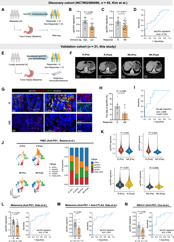 Fig. 7: Baseline intratumoral apCAFs predicts clinical benefits from immunotherapy.