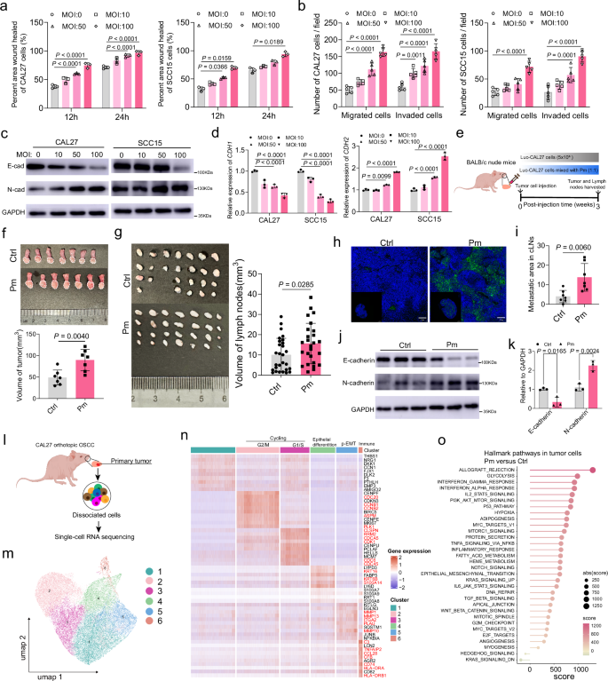 Fig. 2: P. micra promoted OSCC metastasis in vitro and in vivo.