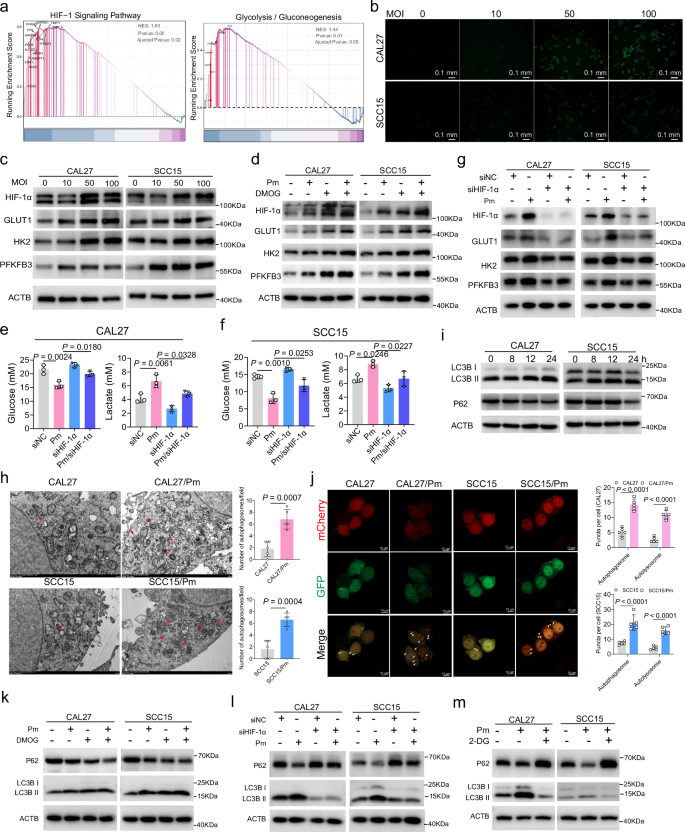 Fig. 3: P. micra activated Hypoxia/HIF-1α, glycolysis and autophagy in OSCC cells.