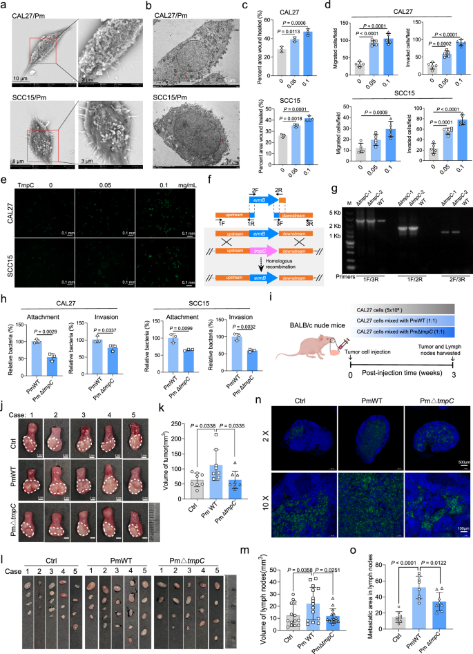 Fig. 4: P. micra interacted with OSCC cells via its surface protein TmpC.