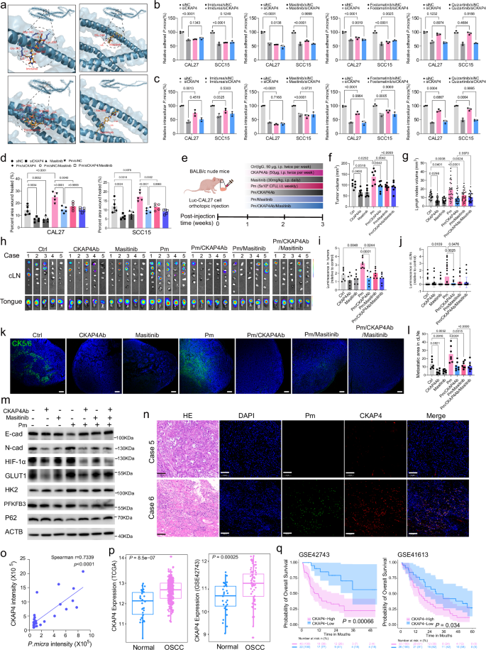Fig. 7: Blockade of CKAP4 attenuated P. micra/TmpC-promoted OSCC metastasis.
