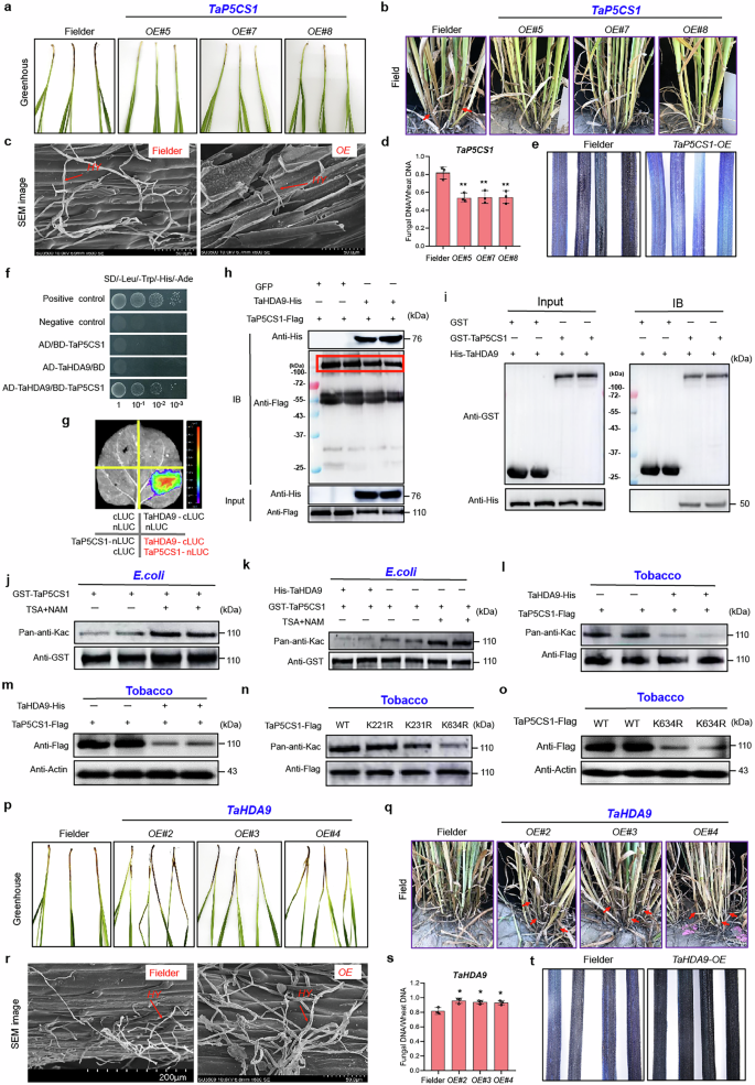 Fig. 5: TaP5CS1 regulated wheat Fusarium crown rot through deacetylation.
