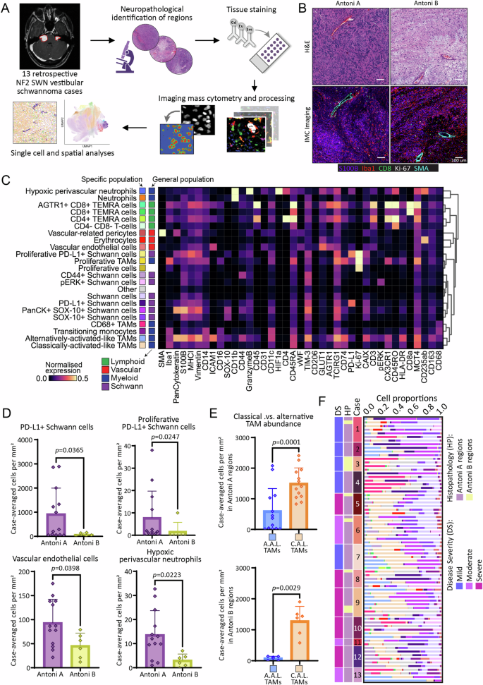 Fig. 1: Imaging mass cytometry (IMC) workflow and generation of the single-cell atlas in NF2 SWN-related vestibular schwannoma.