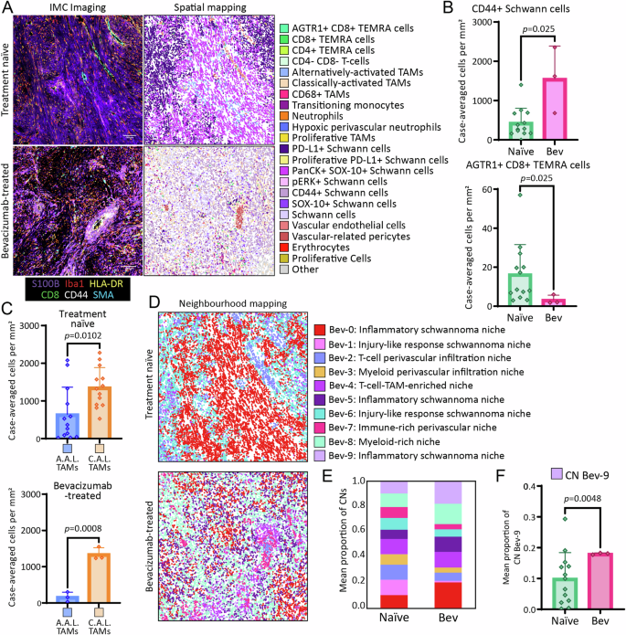Fig. 6: IMC analyses highlight the influence of bevacizumab treatment on the microenvironment in NF2 SWN-related vestibular schwannoma.