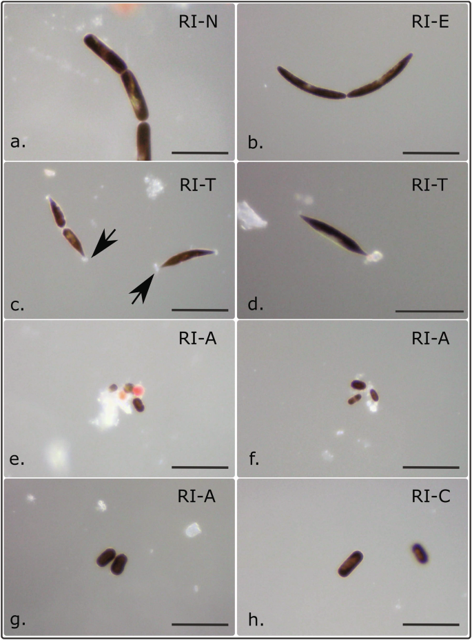 Fig. 3: Representative diversity of Ancylonema spp. morphotypes observed from Robert Island (South Shetland Islands, maritime Antarctic).
