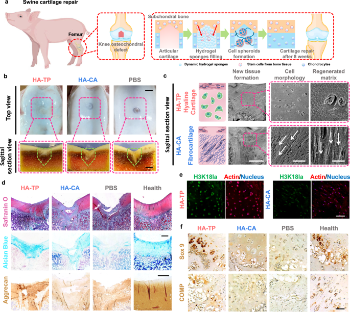 Fig. 8: The cell-free ultra-dynamic hydrogel substantially enhances the in situ regeneration of hyaline cartilage and subchondral bone in swine osteochondral defects.