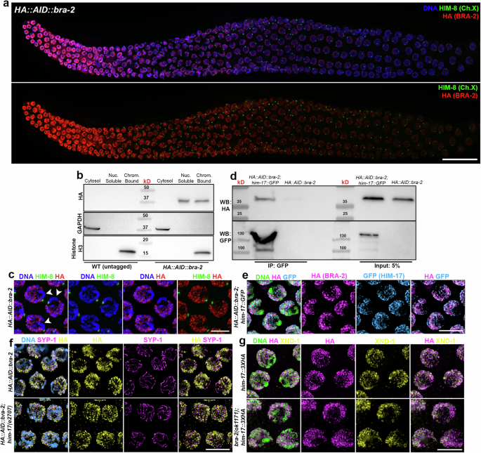 Fig. 2: BRA-2 is enriched on the autosomes and physically interacts with HIM-17.