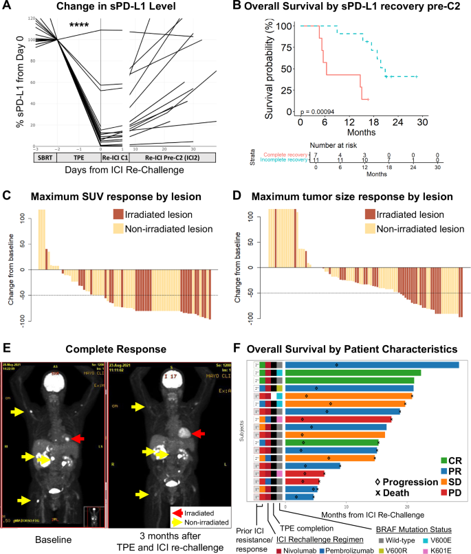 Fig. 1: Treatment outcomes after SBRT, TPE, and ICI re-challenge.