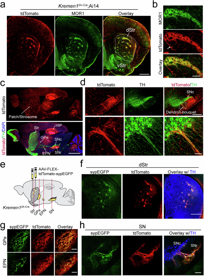 Fig. 2: Distinct distribution patterns of Kremen1+ SPNs in the dorsal striatum and their projections.