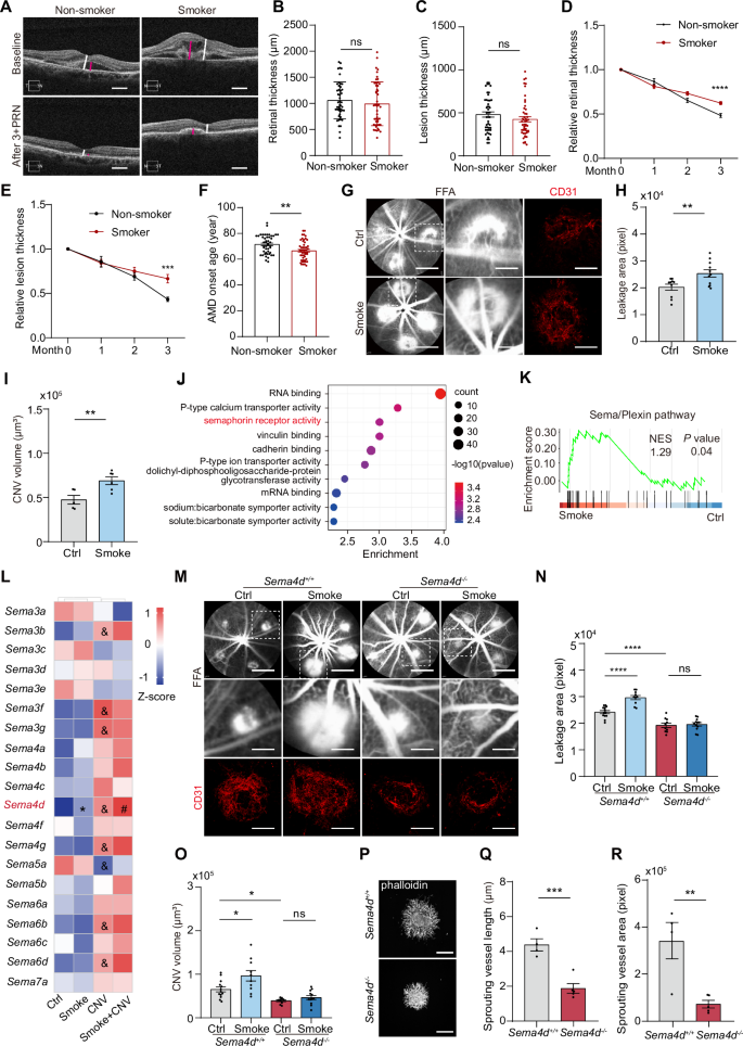 Fig. 1: Impact of Smoking on Anti-VEGF Treatment in nvAMD and CNV in Mice.