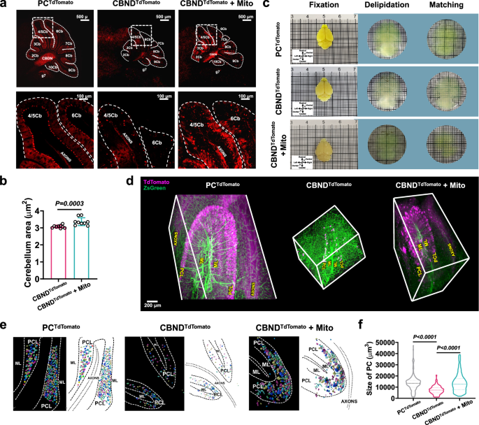 Fig. 4: Significant alleviation of neuronal loss in early-stage CBNDTdTomato mice following mitochondria transplantation.