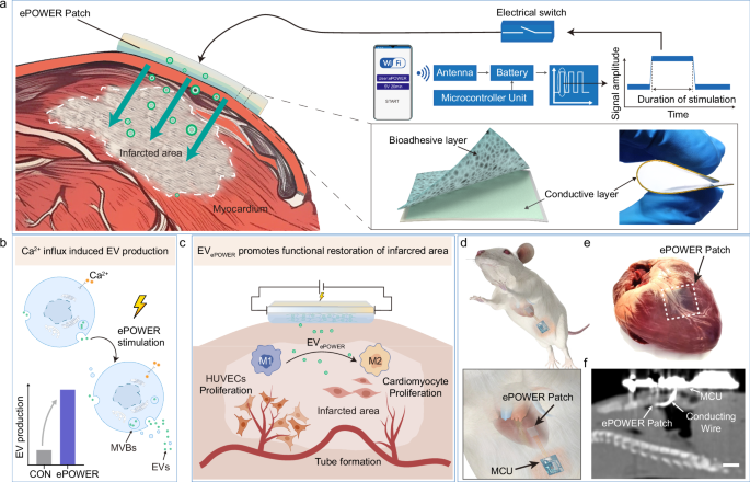Fig. 1: Schematic of implantable, flexible bioelectronics for MI treatment.