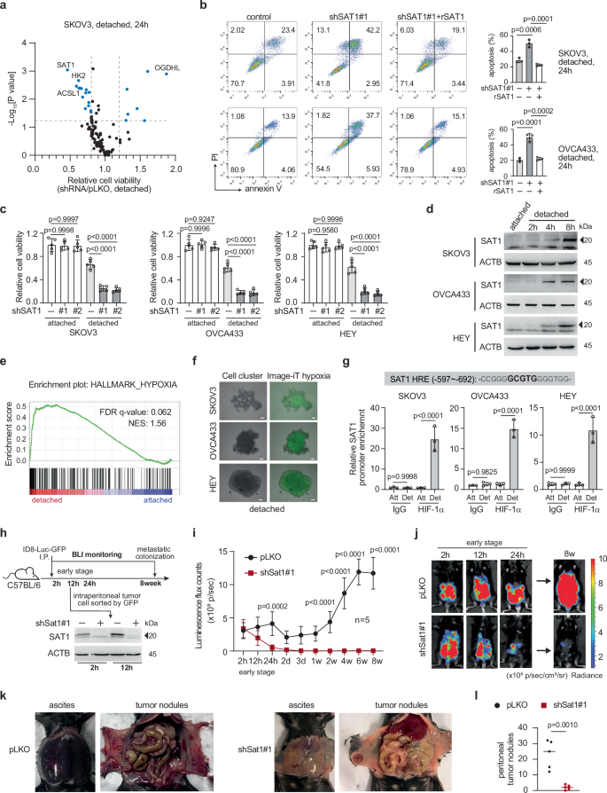 Fig. 1: SAT1 promoted anchorage-independent cell survival and peritoneal metastasis.